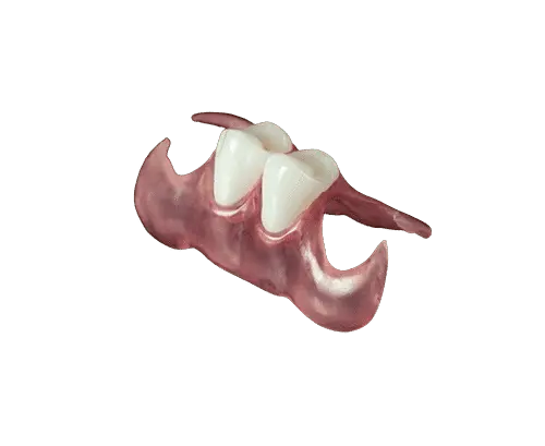 How many missing teeth can this partial denture replace?
