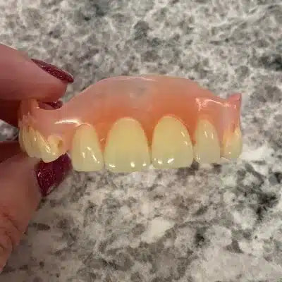Today we discuss how front teeth partial dentures can dramatically change a person&#8217;s life: