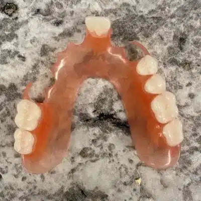 9 Important Considerations When Getting Partial Dentures