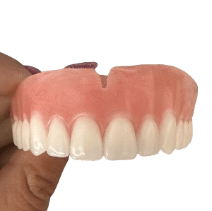 What type of dentures are the most natural looking?