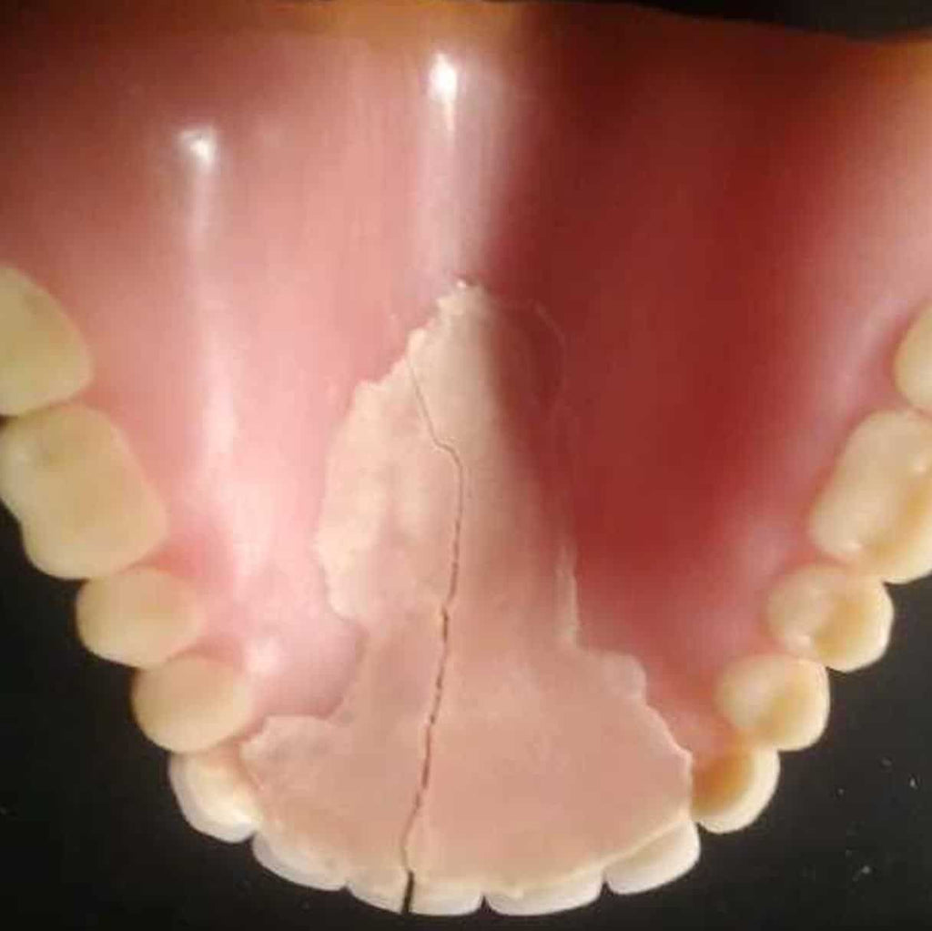 Do Not Repair Your Dentures At Home
