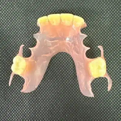 Today We Discuss Partial Dentures for Back Teeth: A Comprehensive Guide