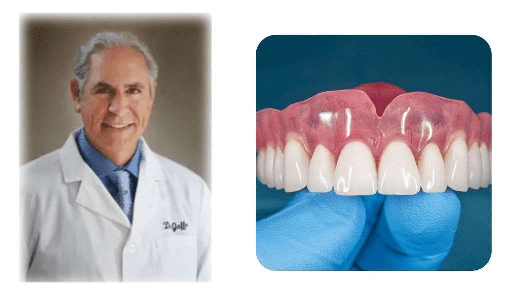 Let&#8217;s Talk About Famous People Who Wear Dentures