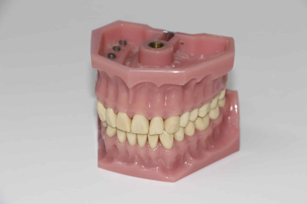 7 Things to Know Before You Order Dentures Online