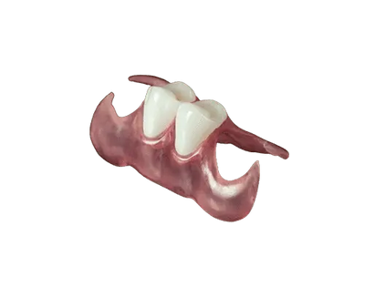 2 tooth unilateral partial