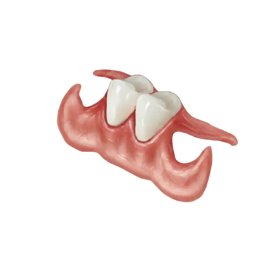 Unilateral Partial 2 Adjoining Teeth - Dentist Directed  - Impression Kit Included Denture Rescue