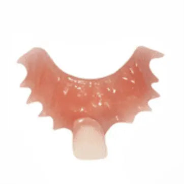 one tooth dental flipper
