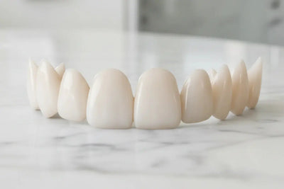SmileBank Veneers - Dentist Directed  - Impression Kit Included Denture Rescue
