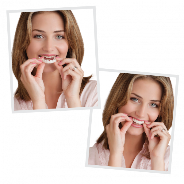 Snap On Smile - Veneers - Pop & Fit Dentist Directed  - Impression Kit Included Denture Rescue