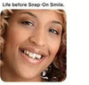 Snap On Smile - Veneers - Pop & Fit Dentist Directed  - Impression Kit Included Denture Rescue