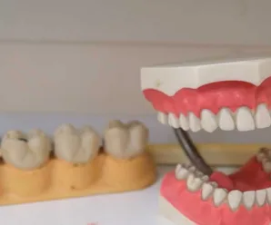 Everything You Need to Know About Mail Order Dentures