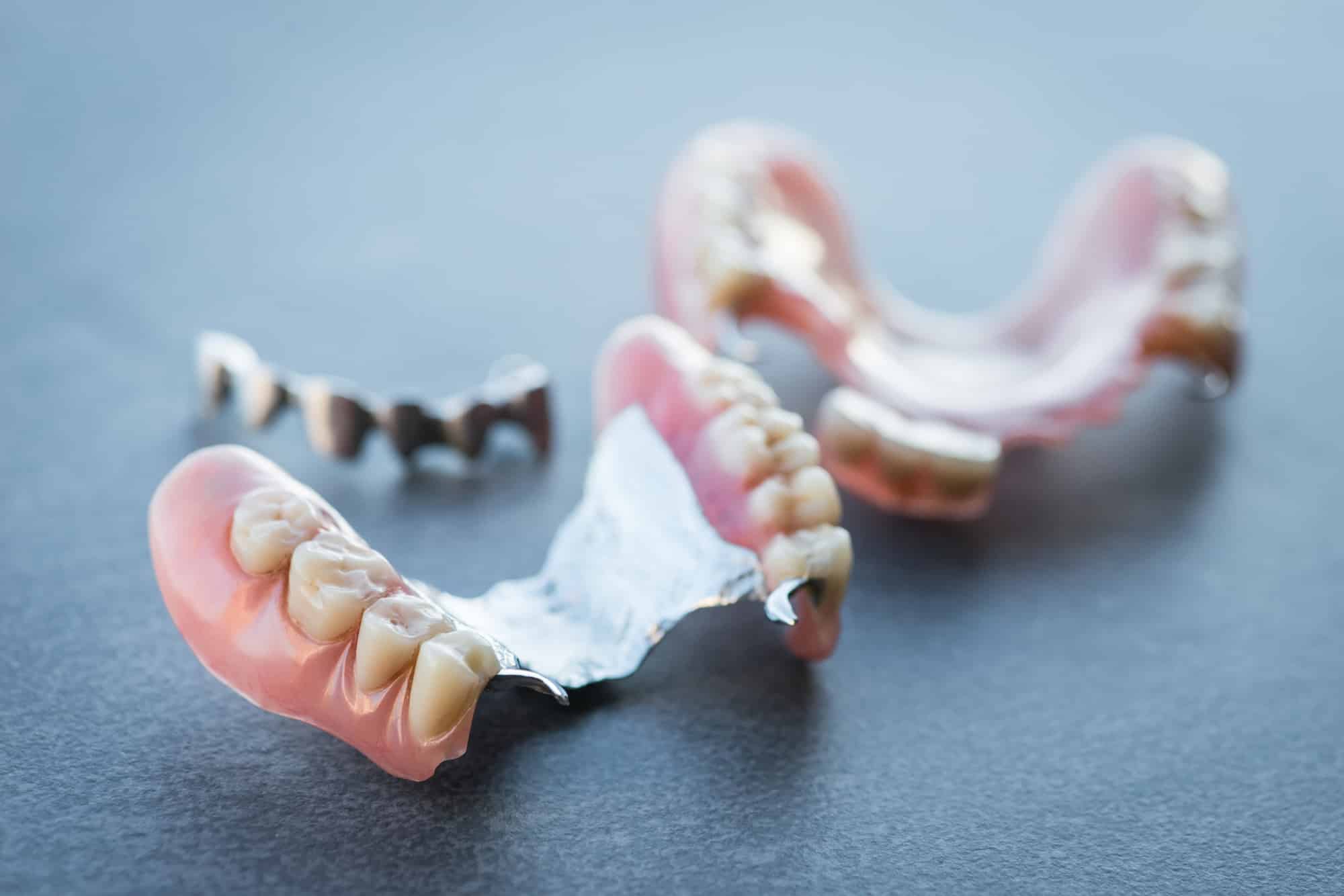The Pros And Cons Of Partial Dentures Explained Partial Dentures