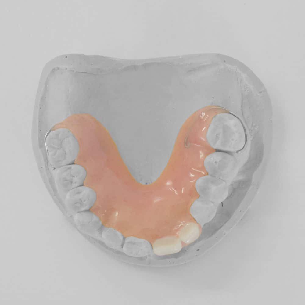 Dental Flipper/Tooth Replacement Online