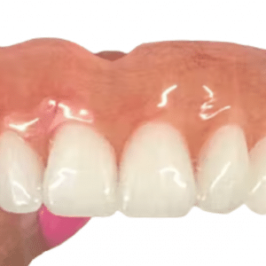 Custom Made Denture - Dentist Directed  - Impression Kit Included