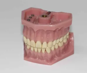 7 Things to Know Before You Order Dentures Online