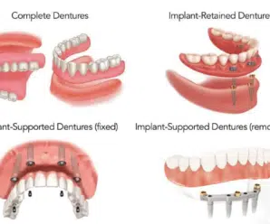 Today We Discuss Snap-In Dentures Cost with Insurance What You Need to Know