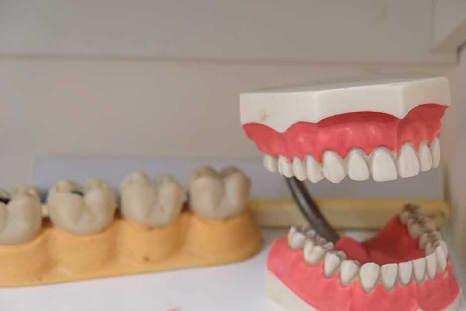 metal dentures