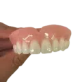 Custom Made Denture - Dentist Directed  - Impression Kit Included - Image 5