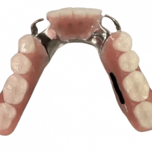 Custom Made Metal Partial Dentures - Dentist Directed  - Impression Kit Included