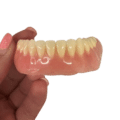 Custom Made Denture - Dentist Directed  - Impression Kit Included - Image 4
