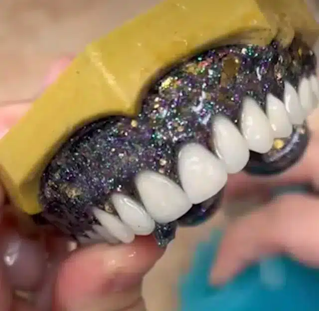 glitter dentures