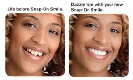 snap on smile before after