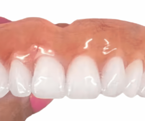 Today I’ll discuss how to get false teeth online.