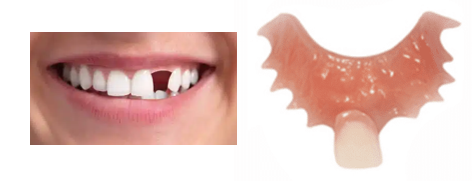 Flipper dental