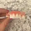 Custom Made Partial Dentures - Dentist Directed  - Impression Kit Included - Image 9