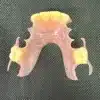 Custom Made Partial Dentures - Dentist Directed  - Impression Kit Included - Image 5